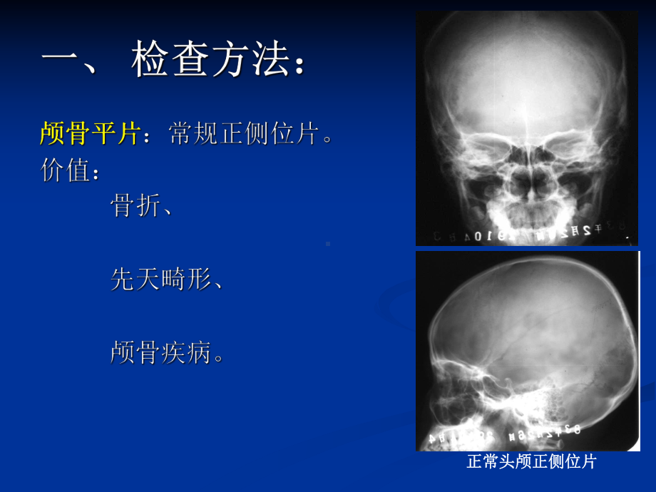 颅脑影像(神内)课件.ppt_第2页