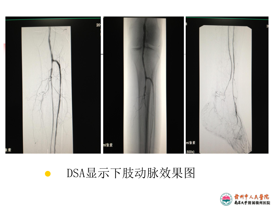 肢血管超声规范检查与诊断课件.ppt_第2页