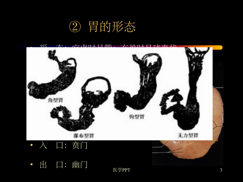 《认识胃与肠》课件.ppt_第3页