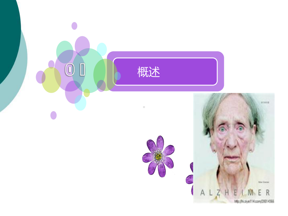 阿尔兹海默症的康复与护理课件.ppt_第2页