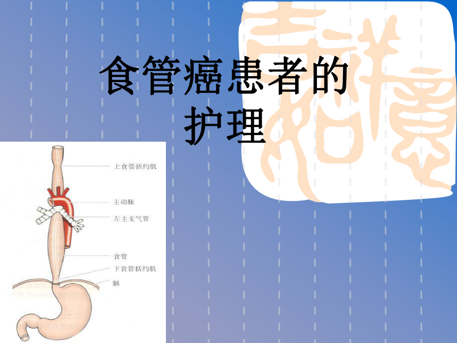 食管癌患者的课件.ppt_第1页