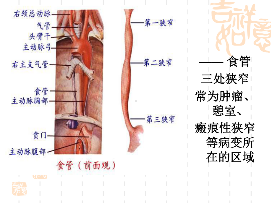 食管癌患者的课件.ppt_第3页