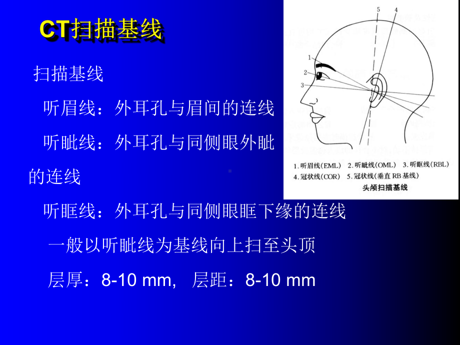 最新头颅CT扫描技术课件.ppt_第3页