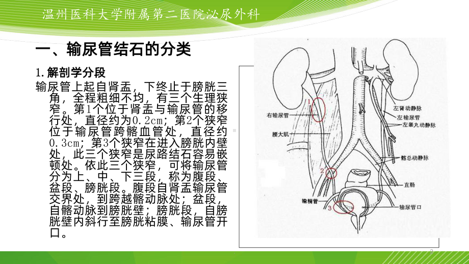 输尿管结石的微创治疗课件.ppt_第2页