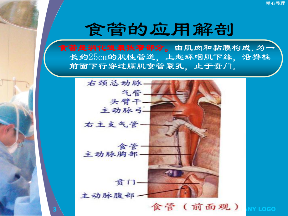 食管异物最新课件.ppt_第3页