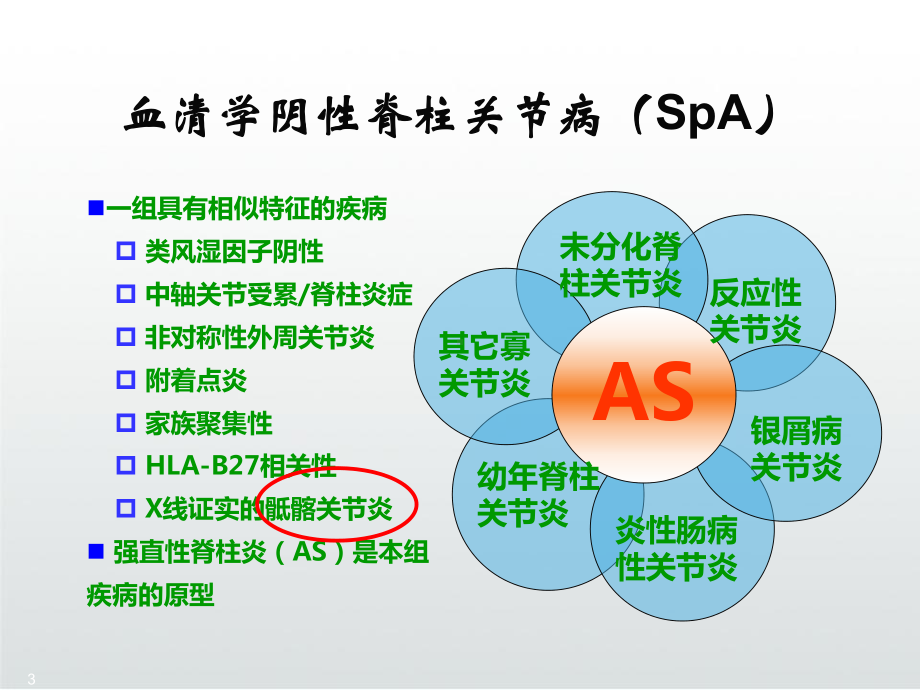 骶髂关节炎影像诊断鉴别课件.ppt_第3页