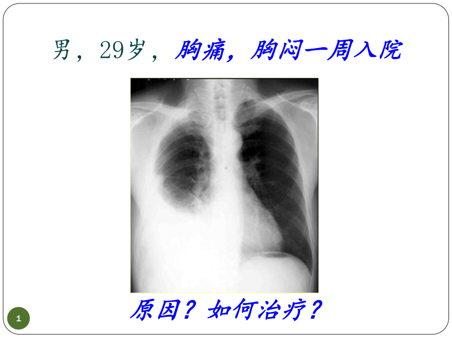 胸膜疾病讲课课件.ppt_第1页