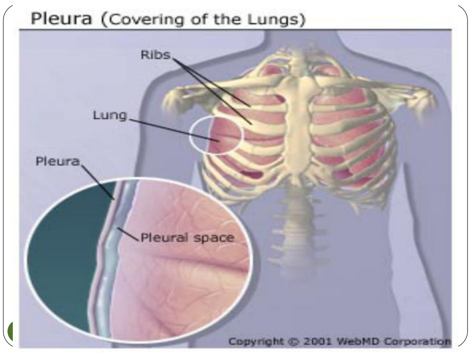 胸膜疾病讲课课件.ppt_第3页