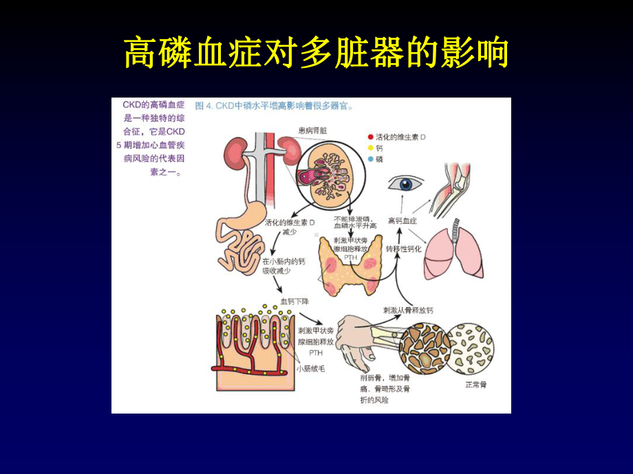 医院管理案例碳酸镧的安全性及疗效课件.ppt_第3页