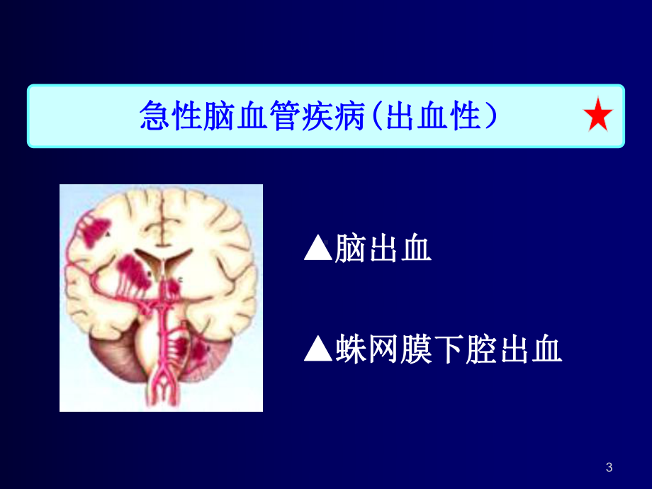 脑出血的护理教学课件最新版.ppt_第3页