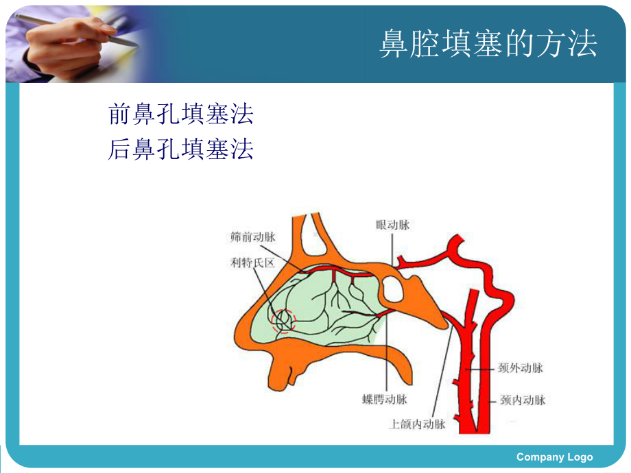 鼻腔填塞术后减轻疼痛及口干的循证护理查房1课件.ppt_第3页