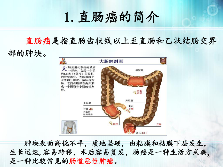 腹腔镜下直肠癌手术的配合课件.pptx_第3页