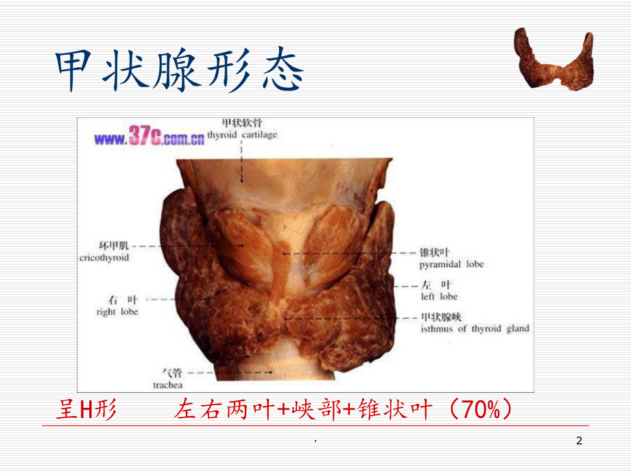 甲状腺肿瘤的护理课件.ppt_第2页