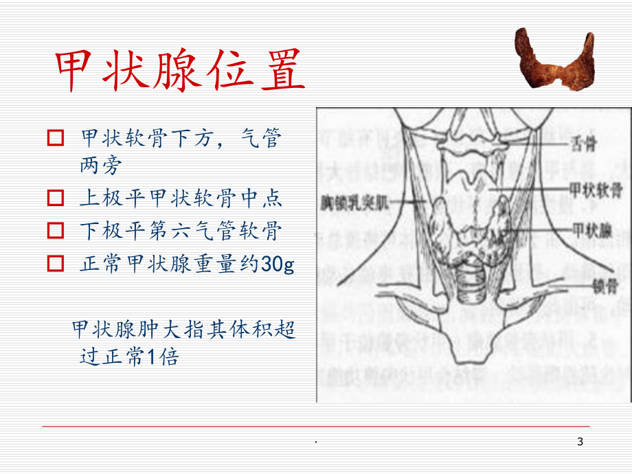 甲状腺肿瘤的护理课件.ppt_第3页