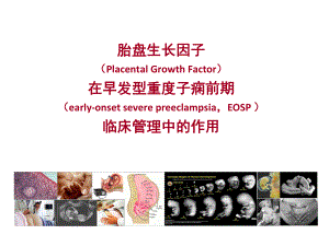 胎盘生长因子与早发型子癎前期解析课件.pptx