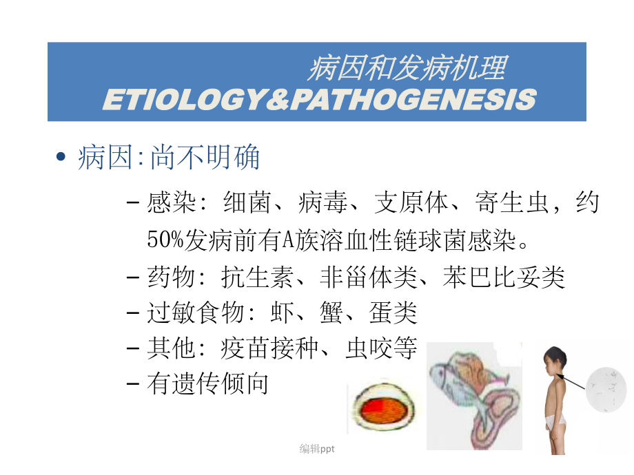 过敏性紫癜个人整理课件.pptx_第3页