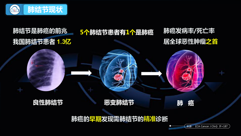 DeepNet肺结节人工智能课件.pptx_第2页