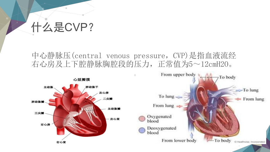 CVP监测及护理要点课件.ppt_第3页