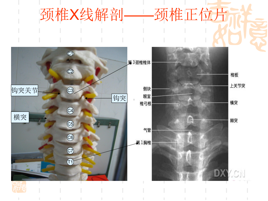 颈椎X线阅片课件.pptx_第3页