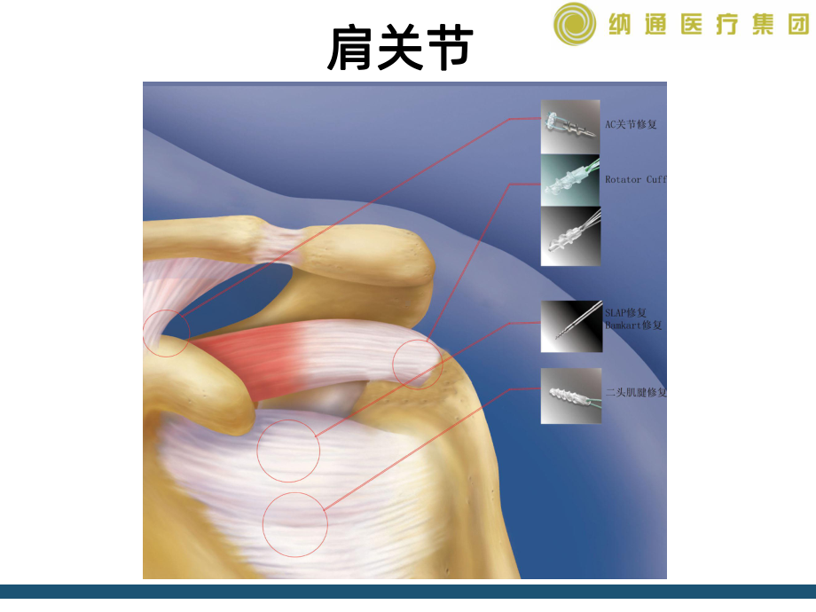 肩关节不稳课件.ppt_第2页