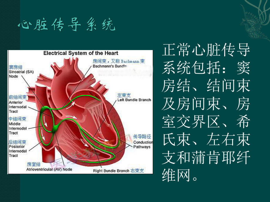 起搏器植入术后病人的护理课件.pptx_第3页