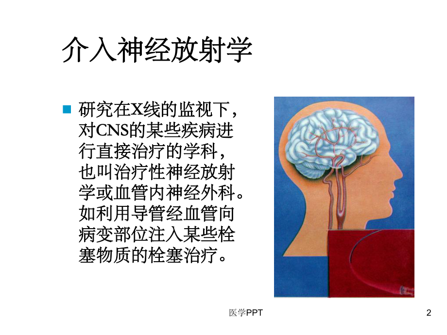 《出血性脑血管病》课件.ppt_第2页