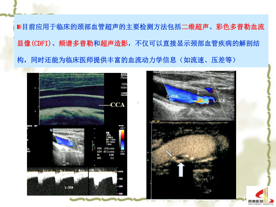 颈部血管超声检查-2013课件.ppt_第3页