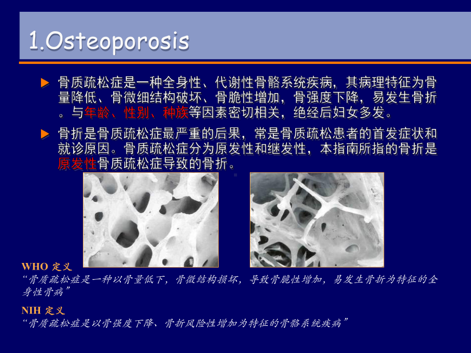 骨质疏松新指南解读课件.ppt_第3页