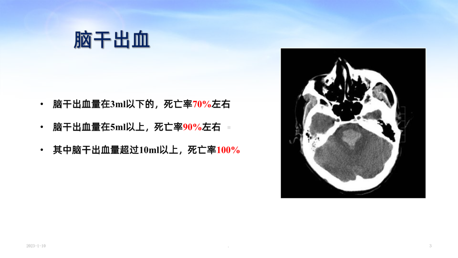 脑干出血后重症管理课件.ppt_第3页