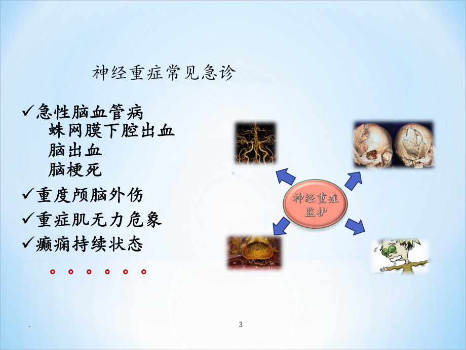 神经重症监护管理-课件.ppt_第3页