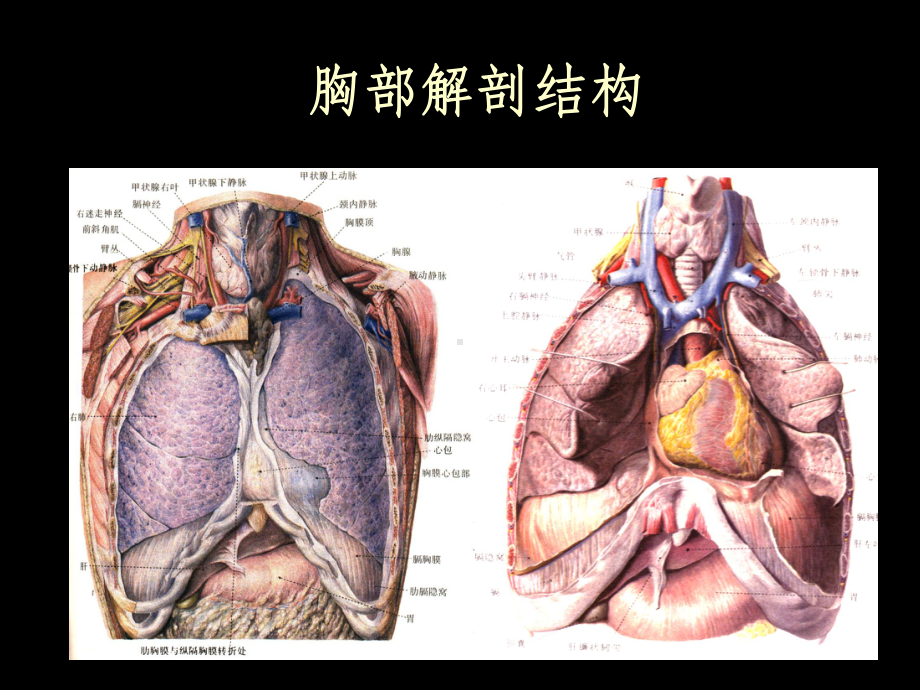 《X线胸片阅读基础》课件.ppt_第3页