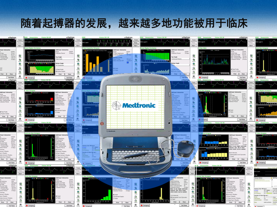 起搏器特殊功能课件.ppt_第2页