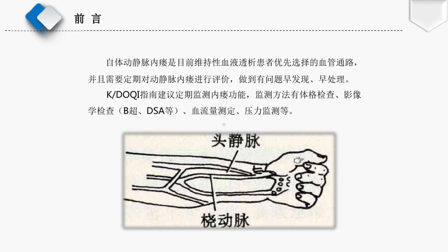 动静脉内瘘的评估课件.pptx_第3页