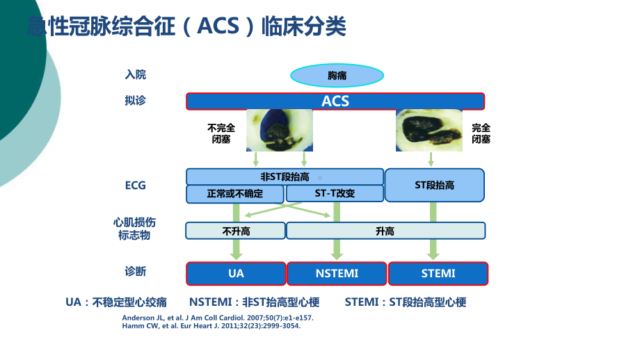 NSTE-ACS诊断标准和治疗原则解读课件.ppt_第3页