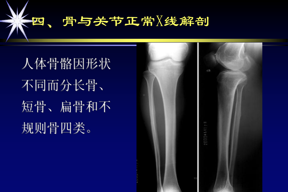 骨伤X射线的课件6学时肖育洪2012.ppt_第3页