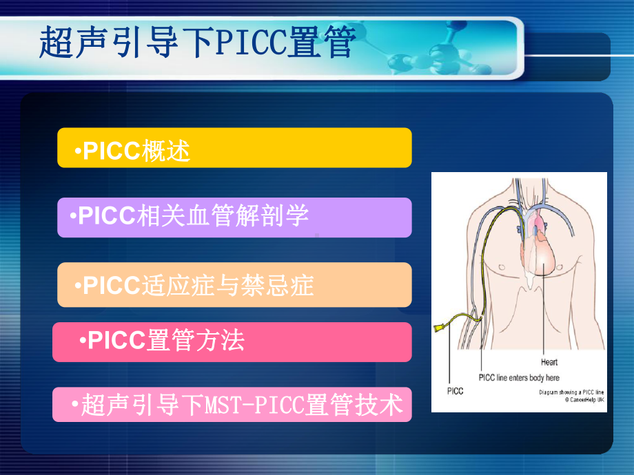 超声引导PICC置管课件.ppt_第3页