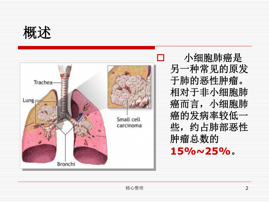 演示小细胞肺癌课件.ppt_第2页