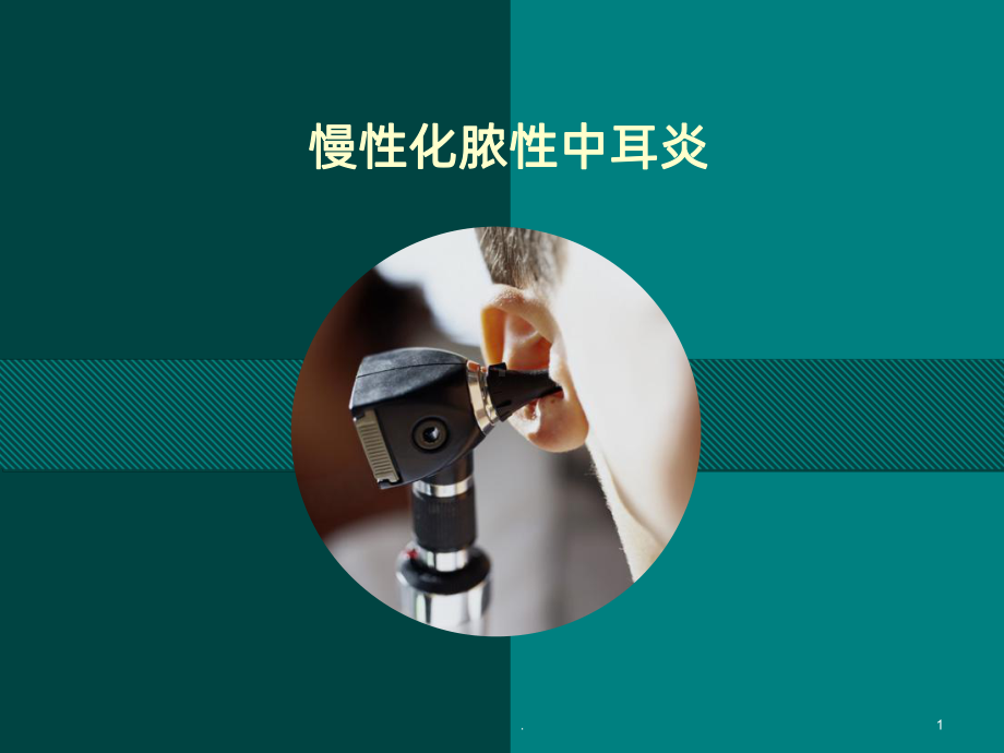 《胆脂瘤型中耳炎》课件.ppt_第1页