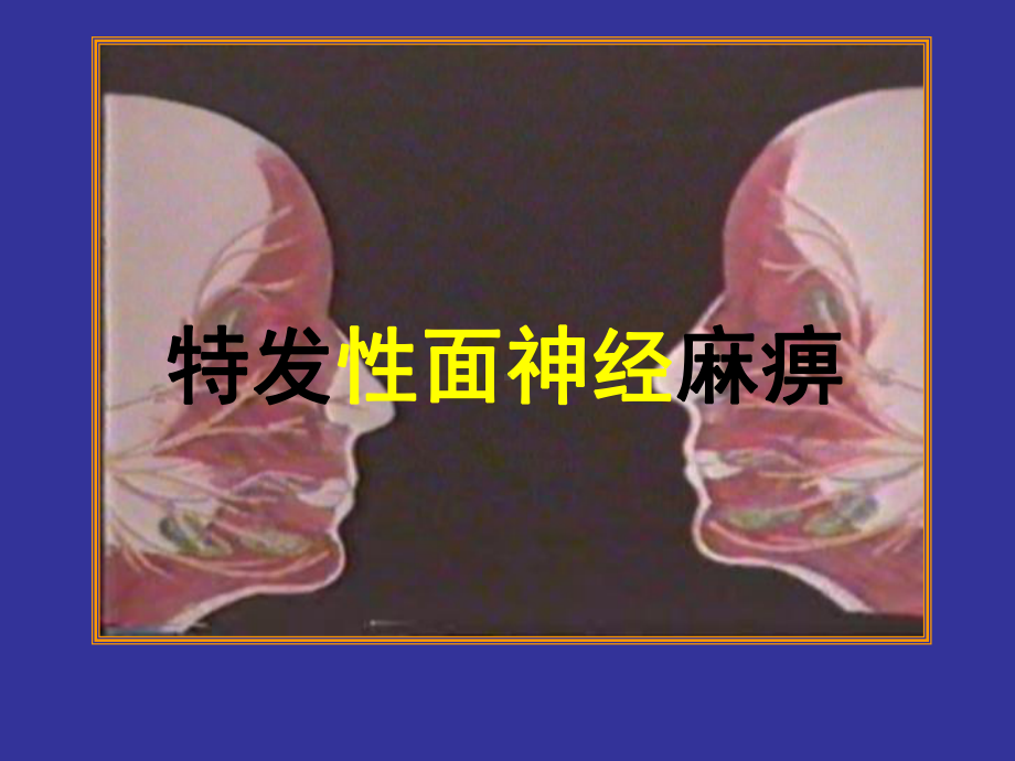 面神经麻痹-讲课稿课件.ppt_第1页