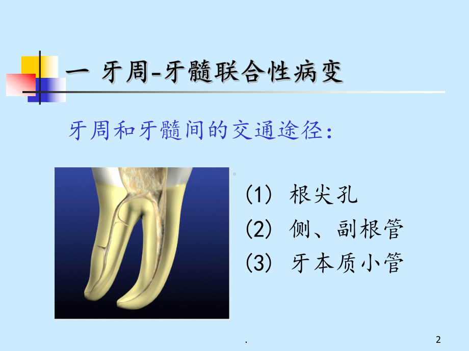 牙周炎伴发病变、牙周病治疗课件.ppt_第2页