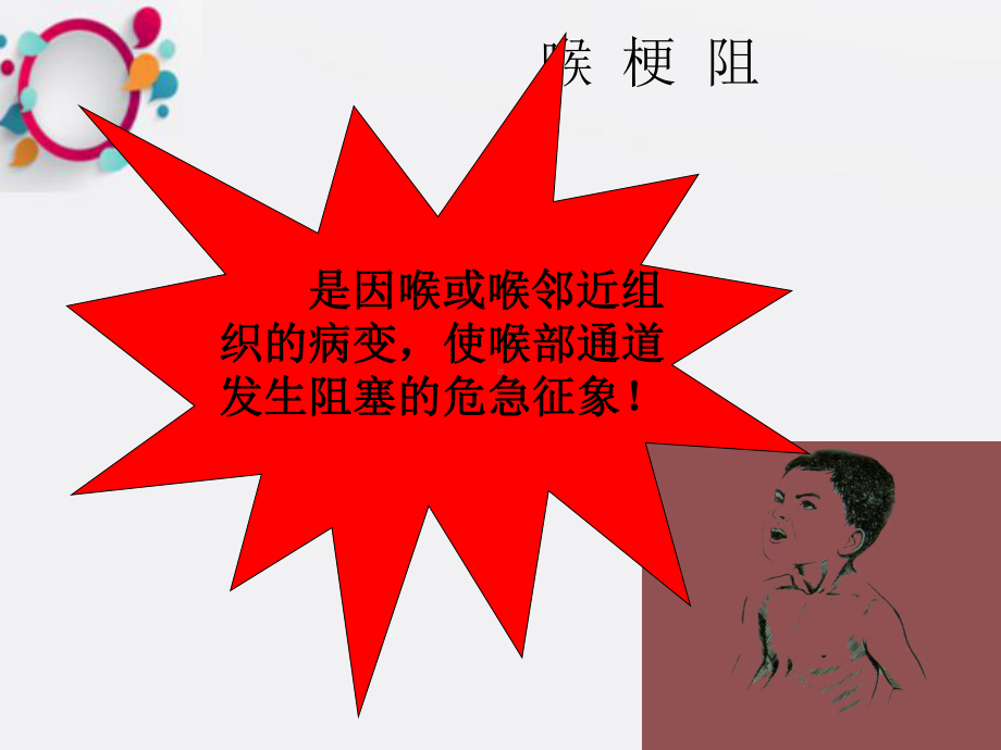 《喉梗阻教学》课件.ppt_第2页