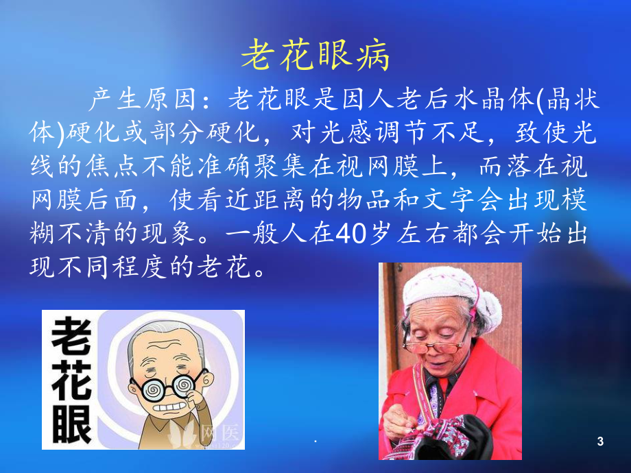 老人眼病与-叶黄素课件.ppt_第3页