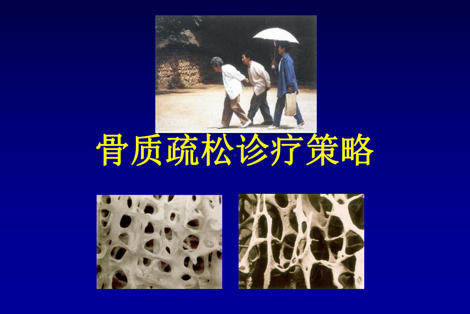 骨质疏松诊疗策略课件.ppt_第1页