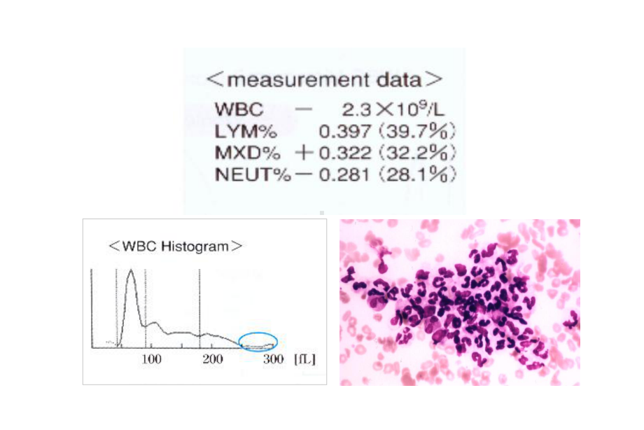 血常规分析中的误差因素及血涂片复检规则(北京)-崔巍课件.ppt_第3页