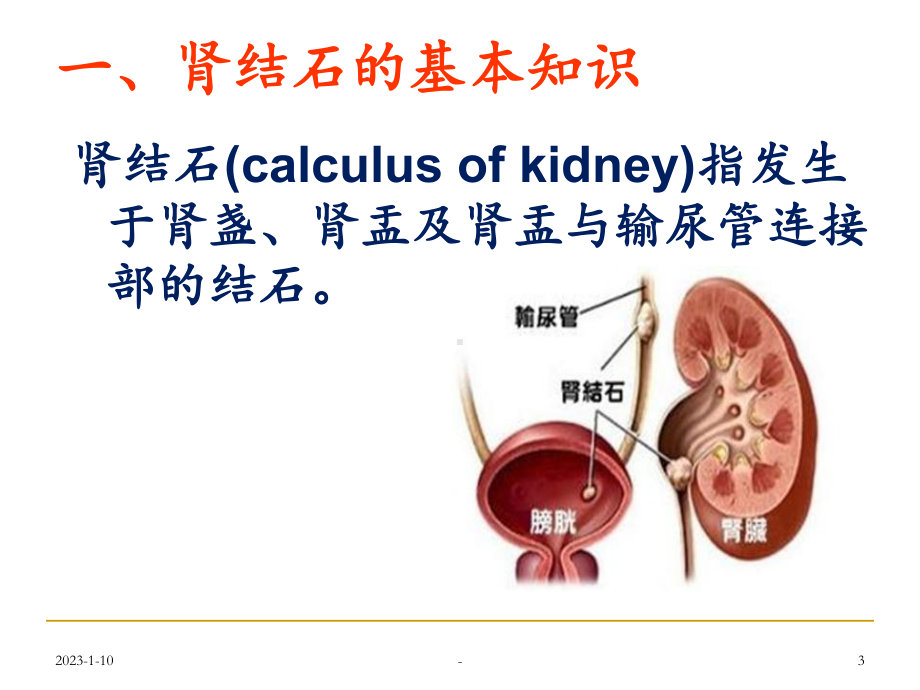 肾结石康复指导课件.ppt_第3页