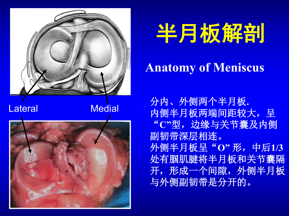 半月板损伤讲课修改版课件.ppt_第2页