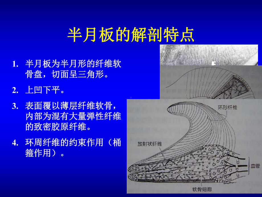 半月板损伤讲课修改版课件.ppt_第3页