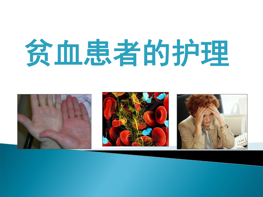 缺铁性贫血患者的护理课件.ppt_第2页