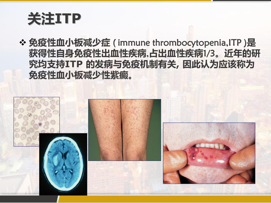 免疫性血小板减少性紫癜-课件.pptx_第3页