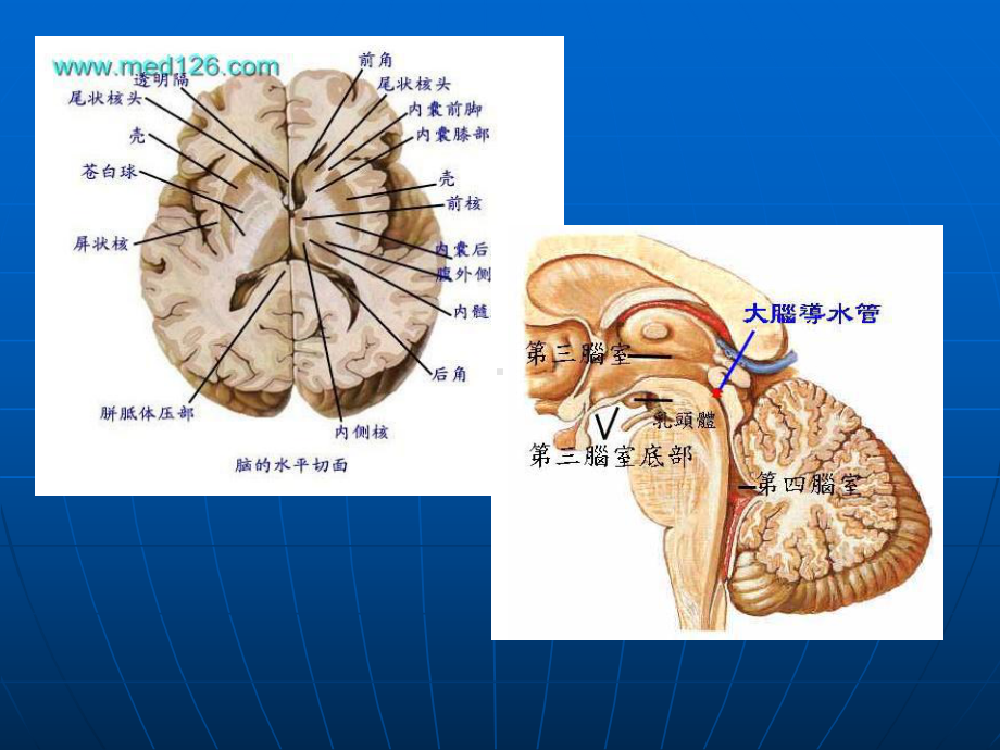 脑出血疾病查房课件.ppt_第3页